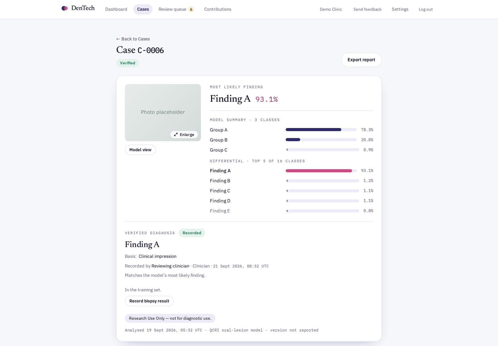 DenTech, a clinical data platform around QCRI's oral-lesion AI model